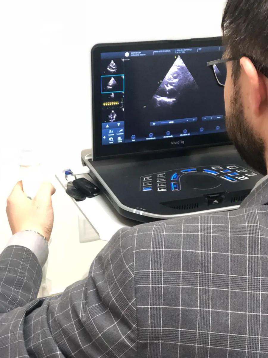 Imagem representativa de Ecocardiograma