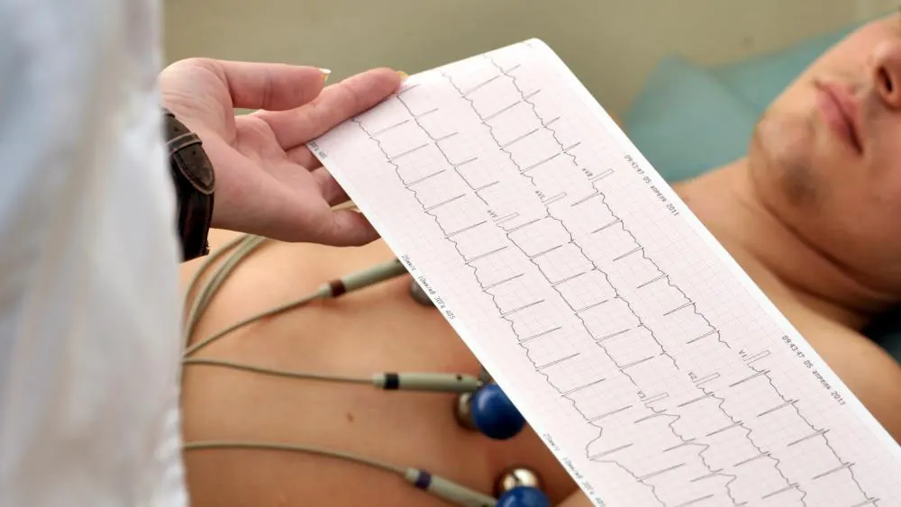 Imagem representativa de Eletrocardiograma (ECG)